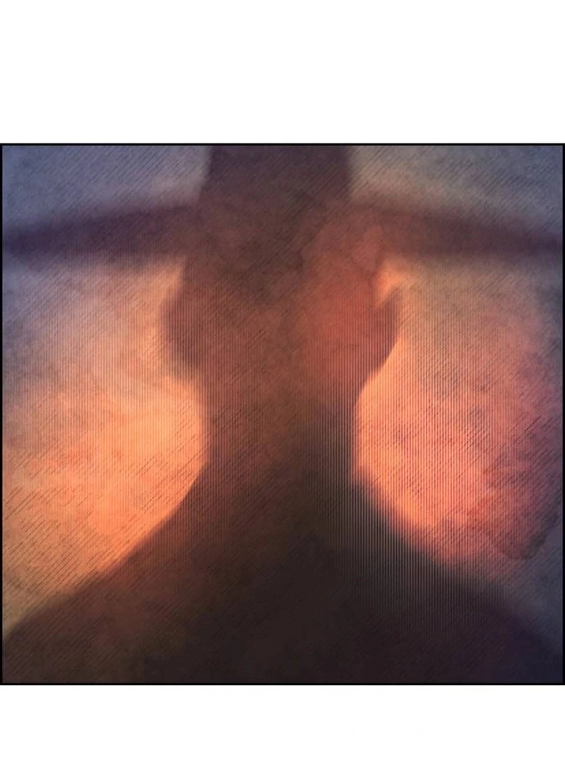 Forever Out Of Reach Chapter 1 - page 24